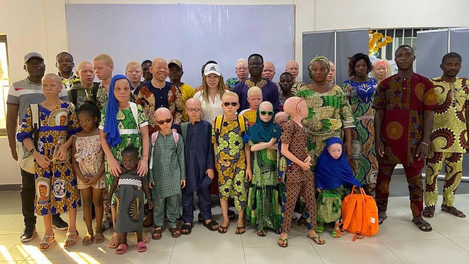 DCW — Sensibilisation albinisme en milieu scolaire